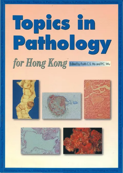 香港病理學研究